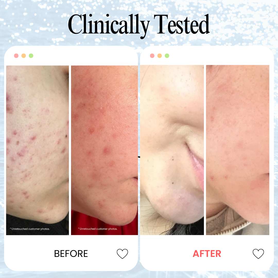 Ultimate Glow Kit – Vitamin C Serum + Collagen Mask