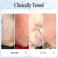 Ultimate Glow Kit – Vitamin C Serum + Collagen Mask