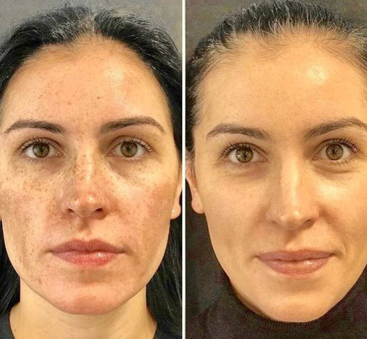 EveryDewy™️ C the Glow! Dark Spot Serum