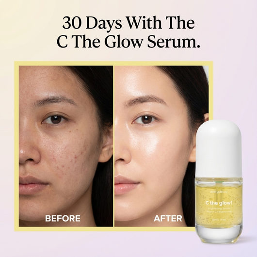 EveryDewy™️ C the Glow! Dark Spot Serum